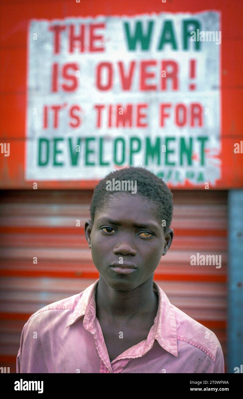 Liberia, Monrovia; boy with one eye blind in front of a sign saying ...