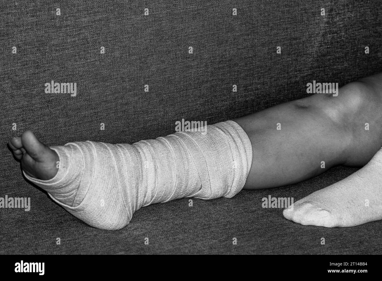 Woman with broken leg. female bandaging foot on the floor. The concept of a sore person with a limb injury. Close-up. Stock Photo
