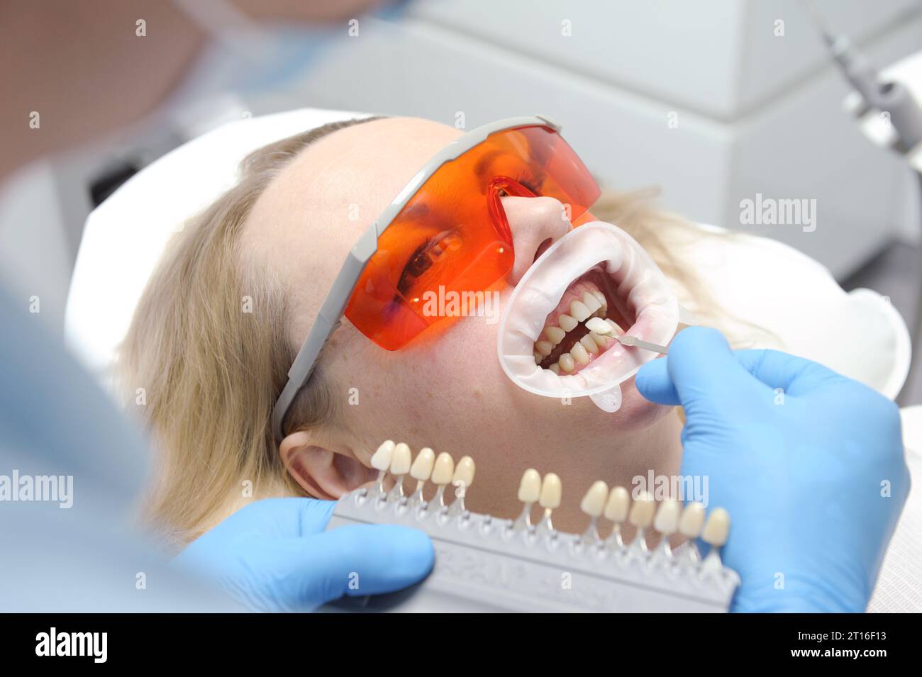 classical dental coloring for determining color of teeth Banner tooth