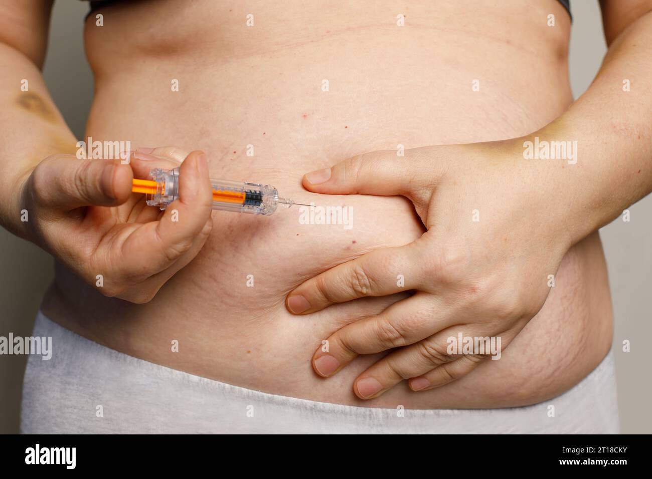 Woman holding syringe making self injection in belly. Health care, medicine treatment, hormonal therapy, in vitro fertilization Stock Photo