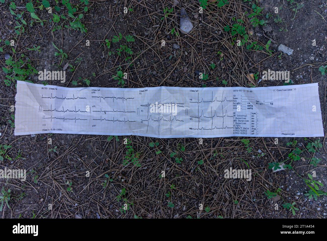 Abandoned ECG tracing on the ground, a poignant symbol of forgotten medical history. Stock Photo