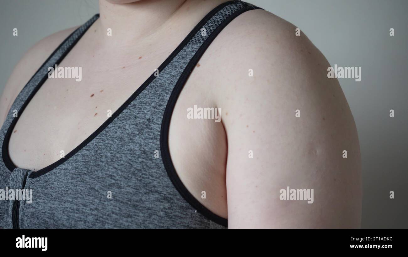 Light-skinned young woman with drooping arms. Sad bad body shape girl ...