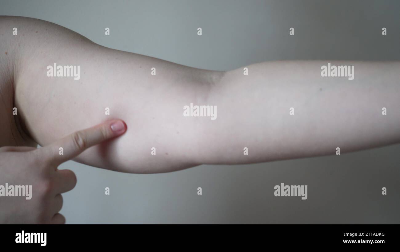 Light-skinned young woman with drooping arms. Sad bad body shape girl ...