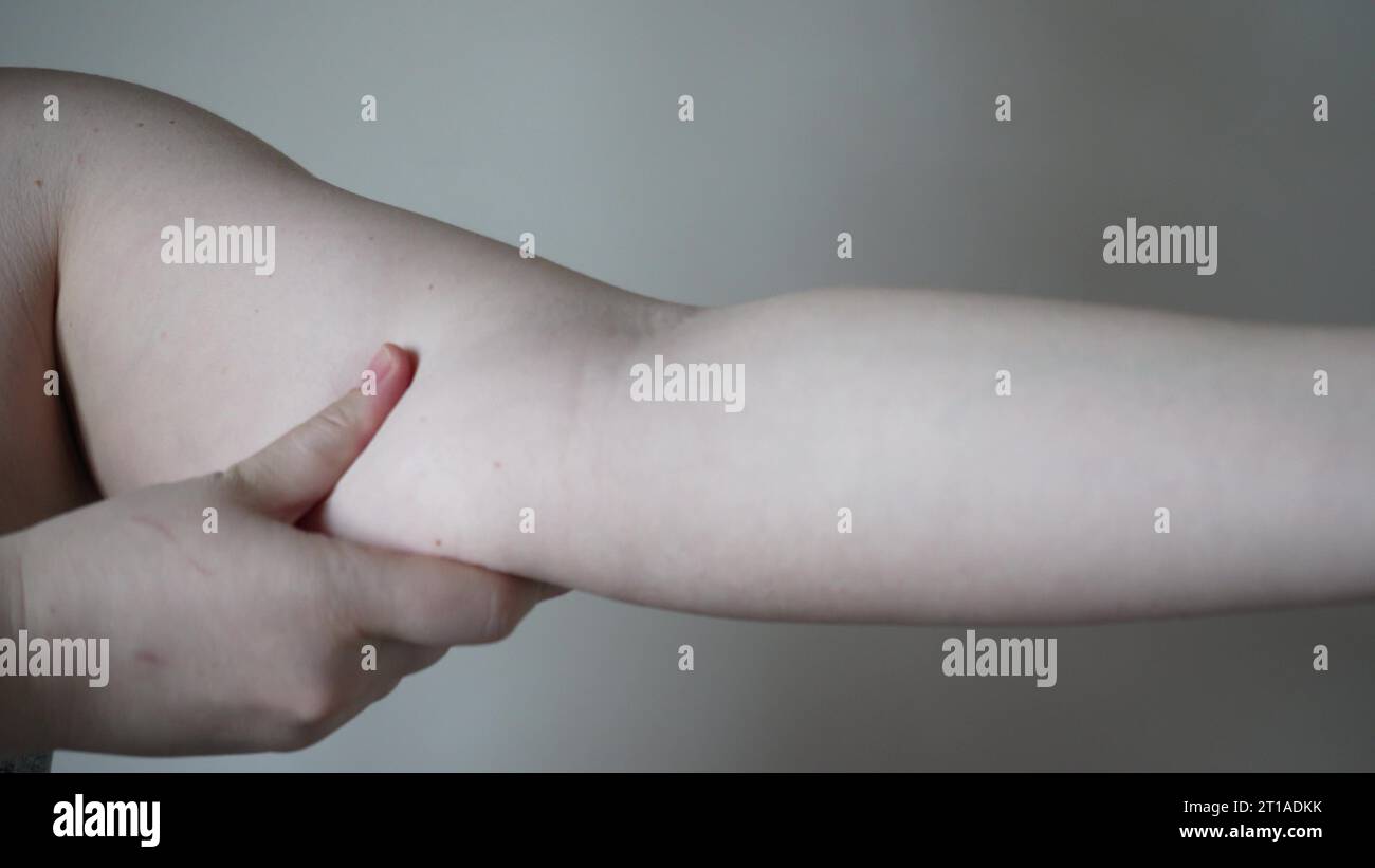 Inflated triceps hi-res stock photography and images - Alamy