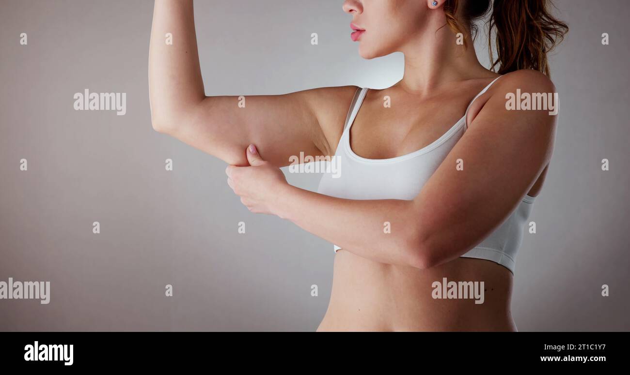 Young woman with excess fat on her back and arms and toned back before and  after losing weight isolated on a white background. Result of diet,  liposuction, training, healthy lifestyle Stock Photo
