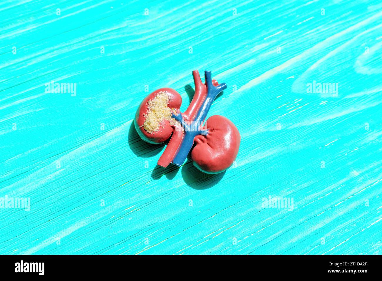 Detailed anatomical model of human kidneys, illustrating kidney health