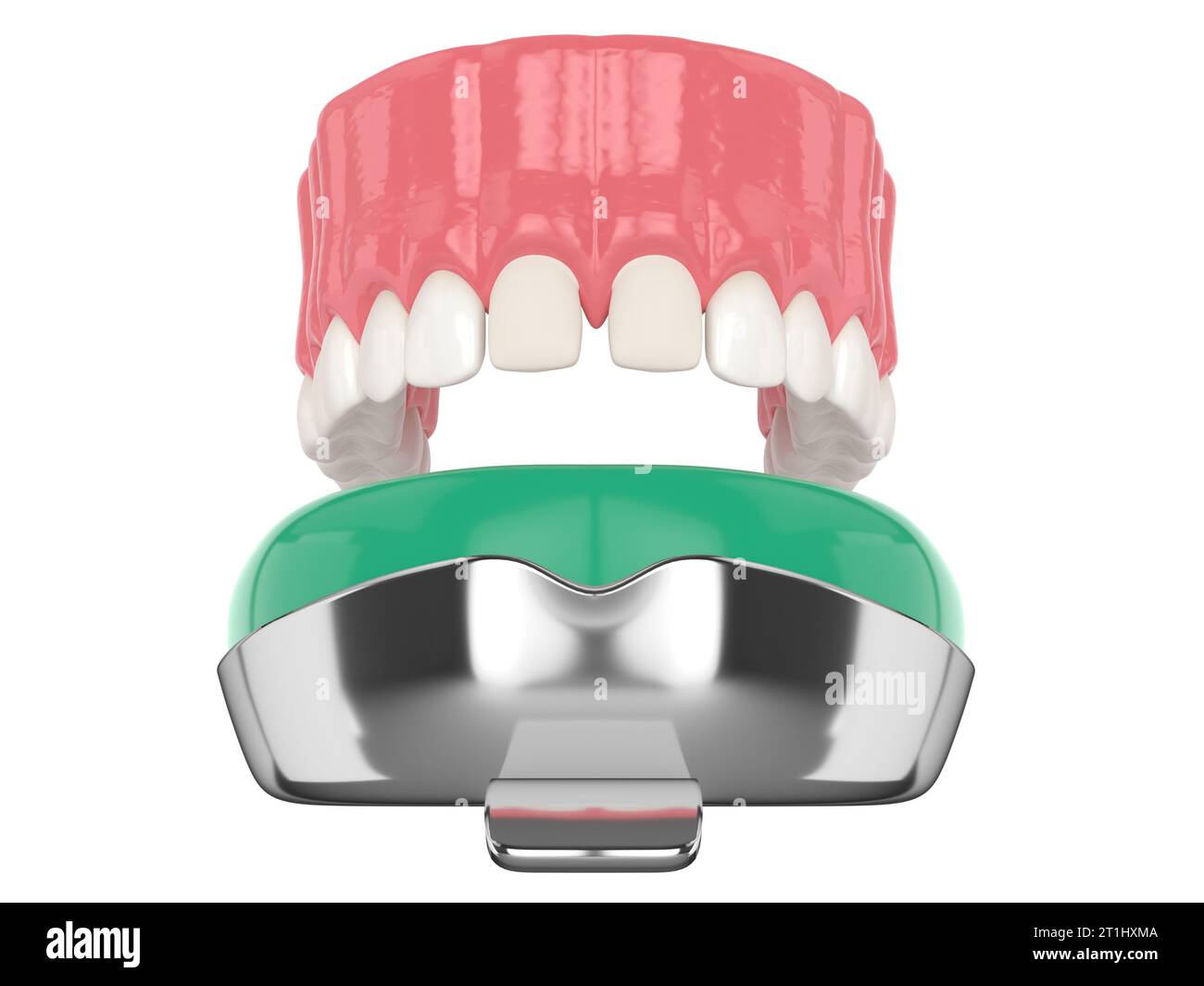 3d render of upper jaw with dental impression tray over white