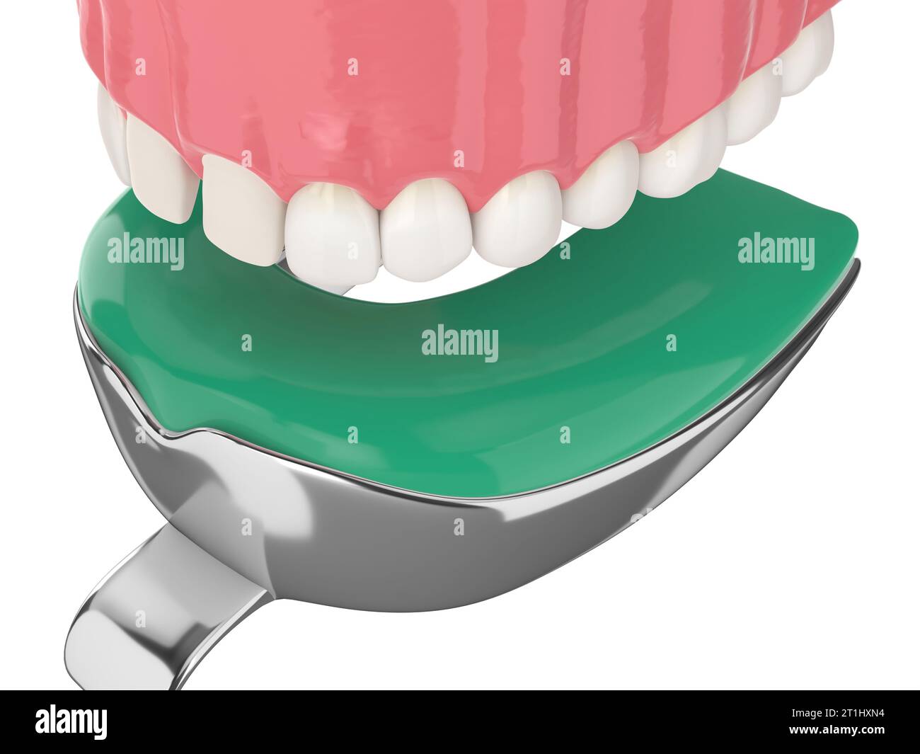3d render of upper jaw with dental impression tray over white