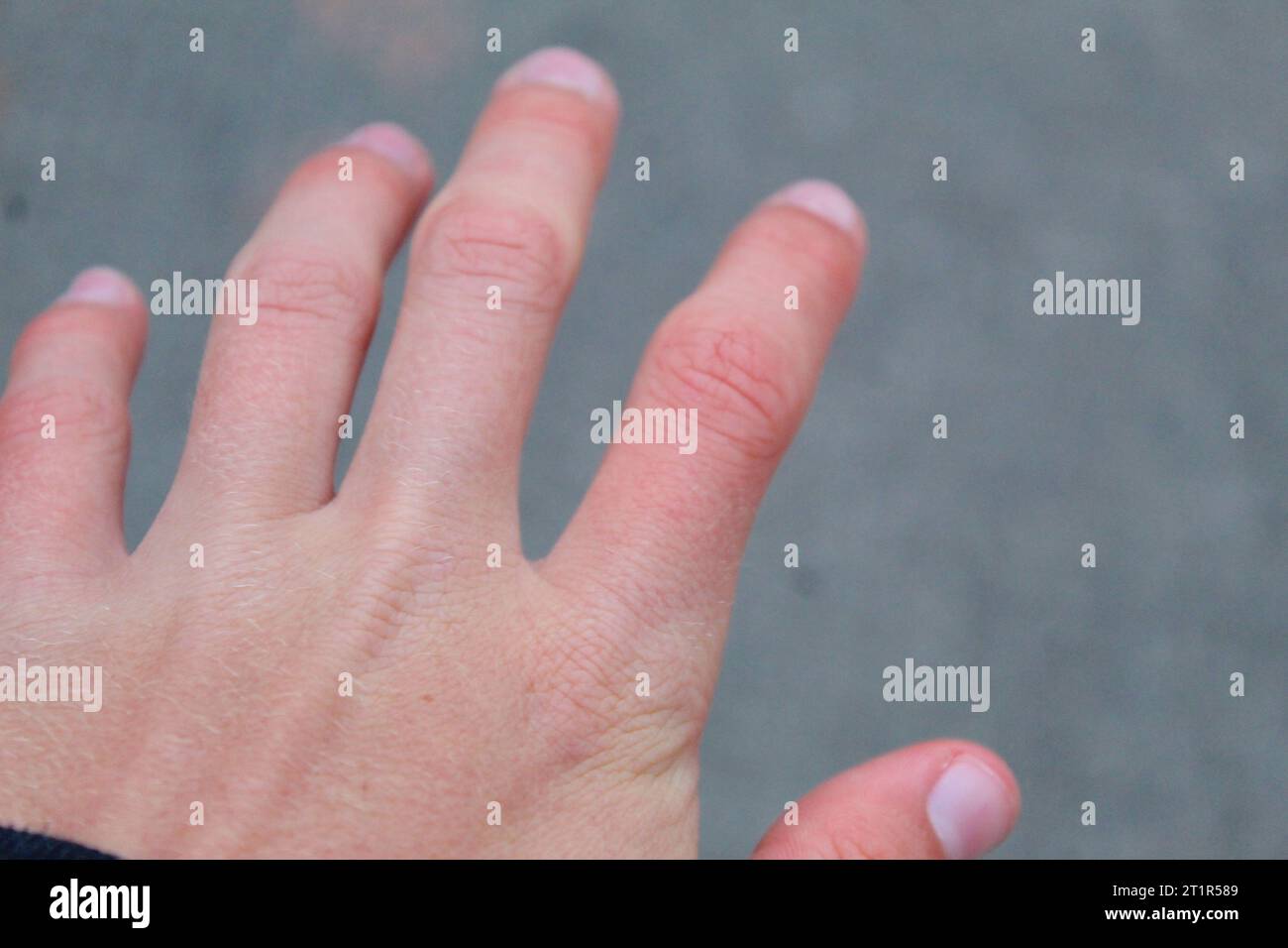 A photo of a white, cold, pale hand reaching out. Stock Photo