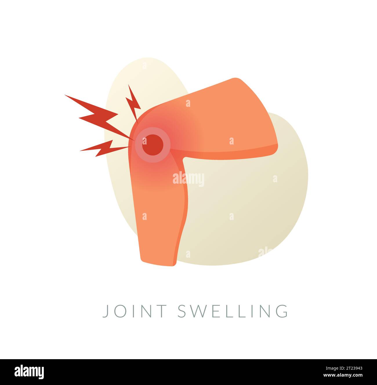 Calf Muscle Pain Joint Swelling Stock Illustration as EPS 10 File