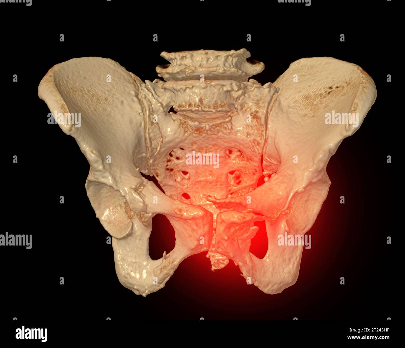 Pubic Ramus Pubic Bone | Anatomy.app