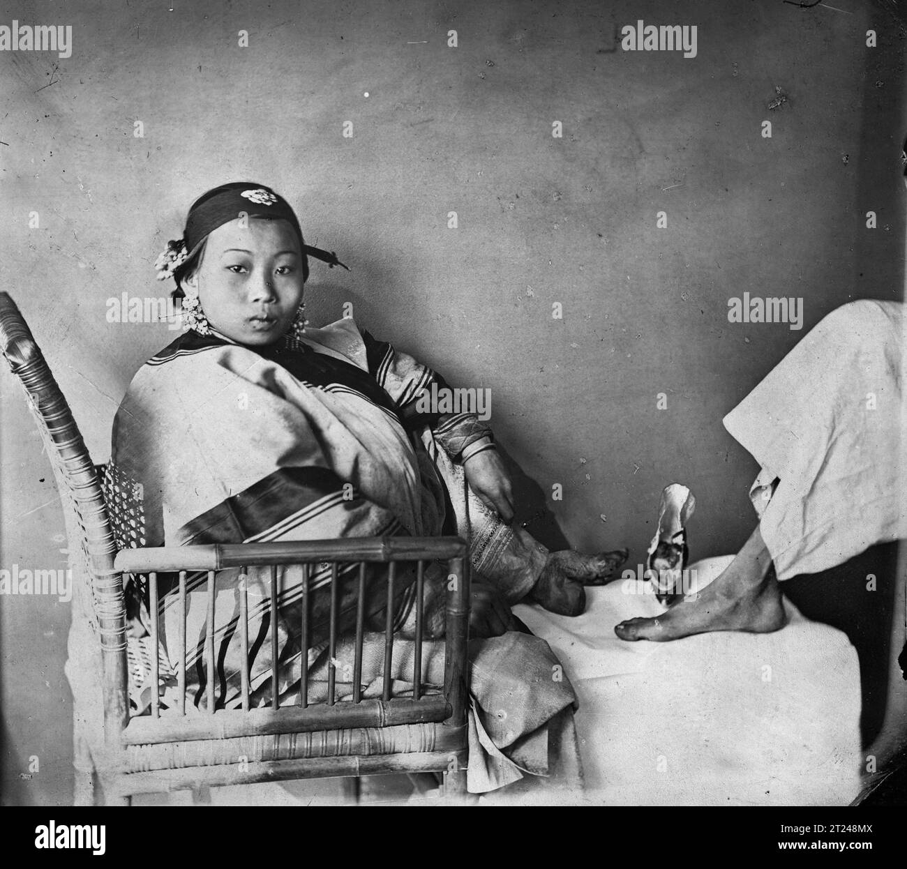 Woman with bound-feet, photo by John Thomson Stock Photo