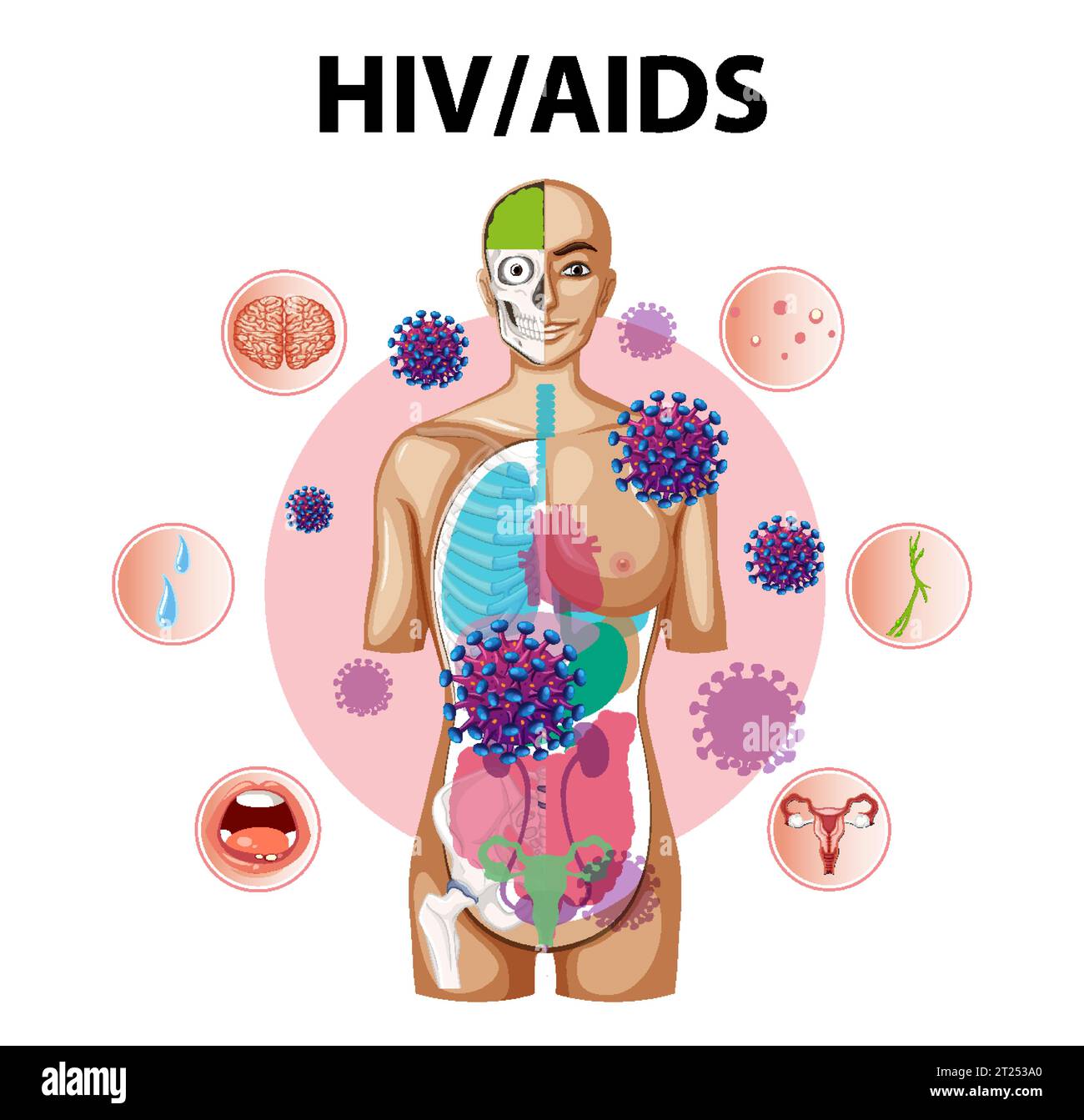 Illustration depicting how HIV/AIDS virus attacks immune system and