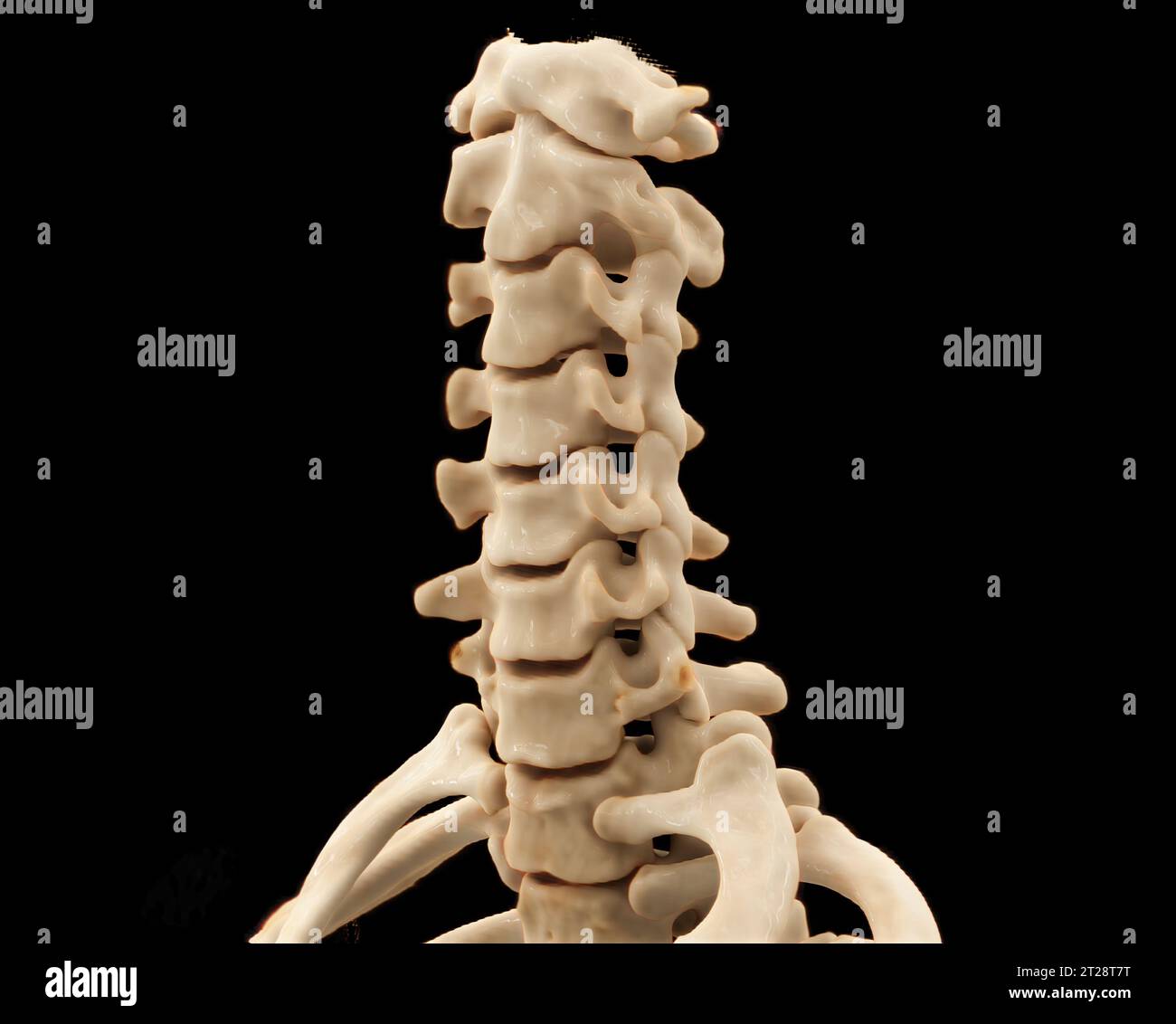 CT scan of C-Spine or Cervical spine 3D rendering for diagnosis ...