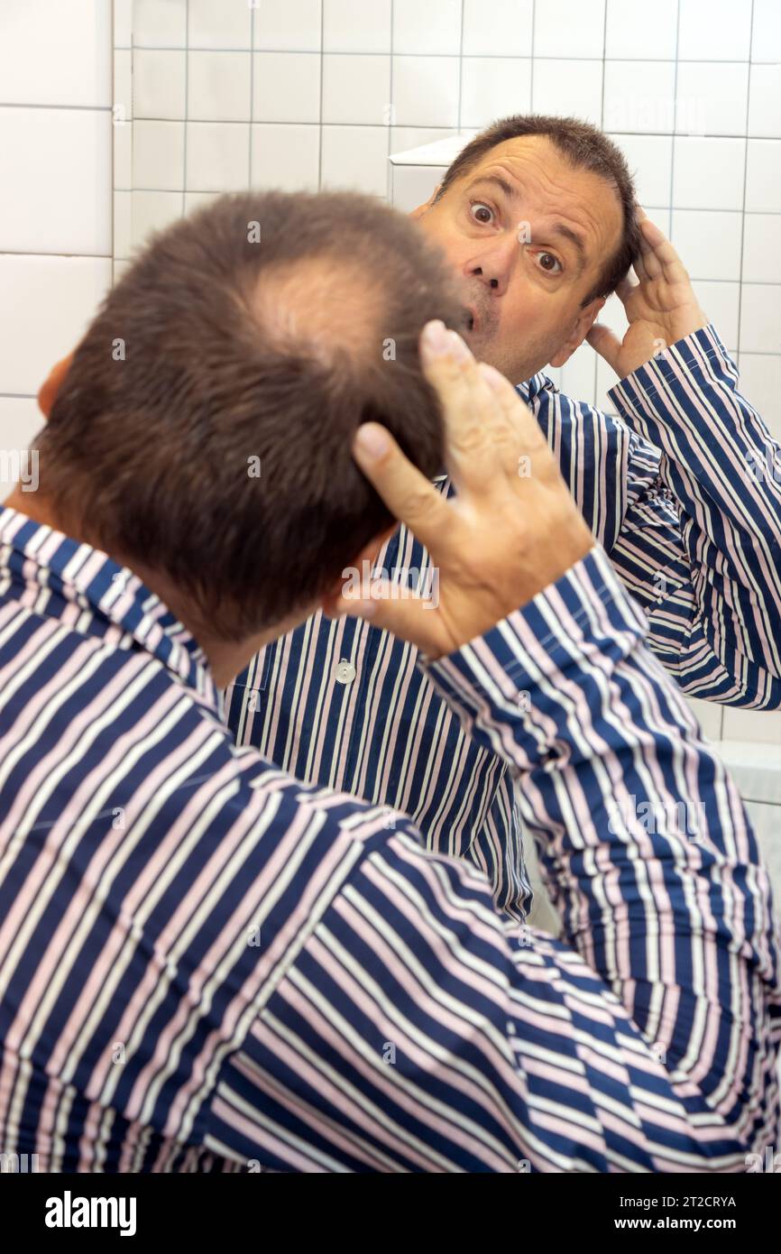Surprised man in pajamas watches the beginning of baldness on his head in the mirror Stock Photo