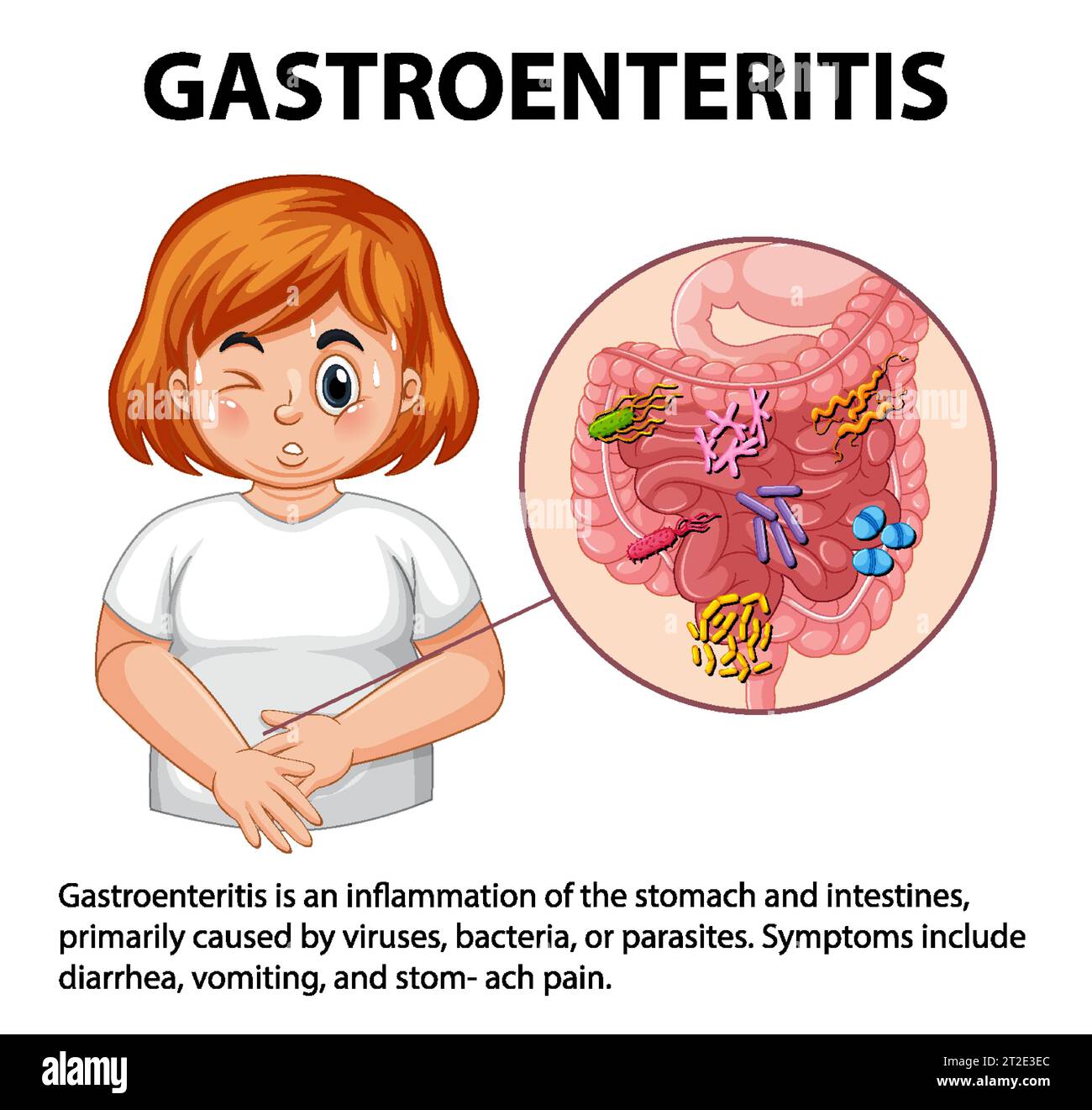 Illustration depicting symptoms of gastroenteritis in a chubby woman