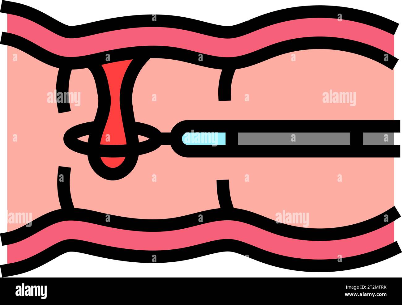 colon polyps gastroenterologist color icon vector illustration Stock