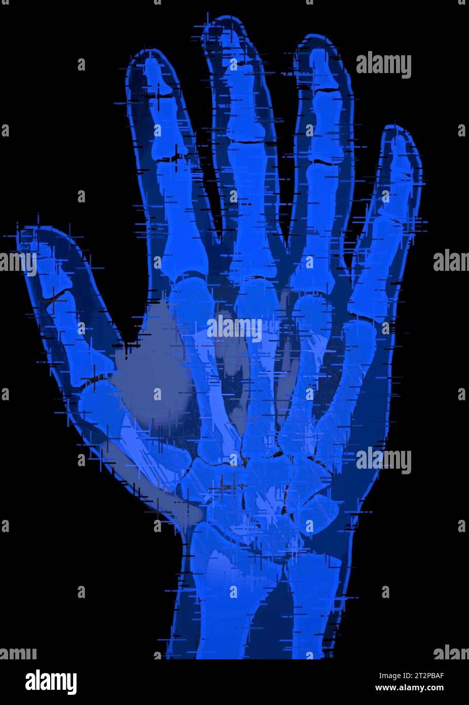 Healthy hand, Xray Stock Photo Alamy