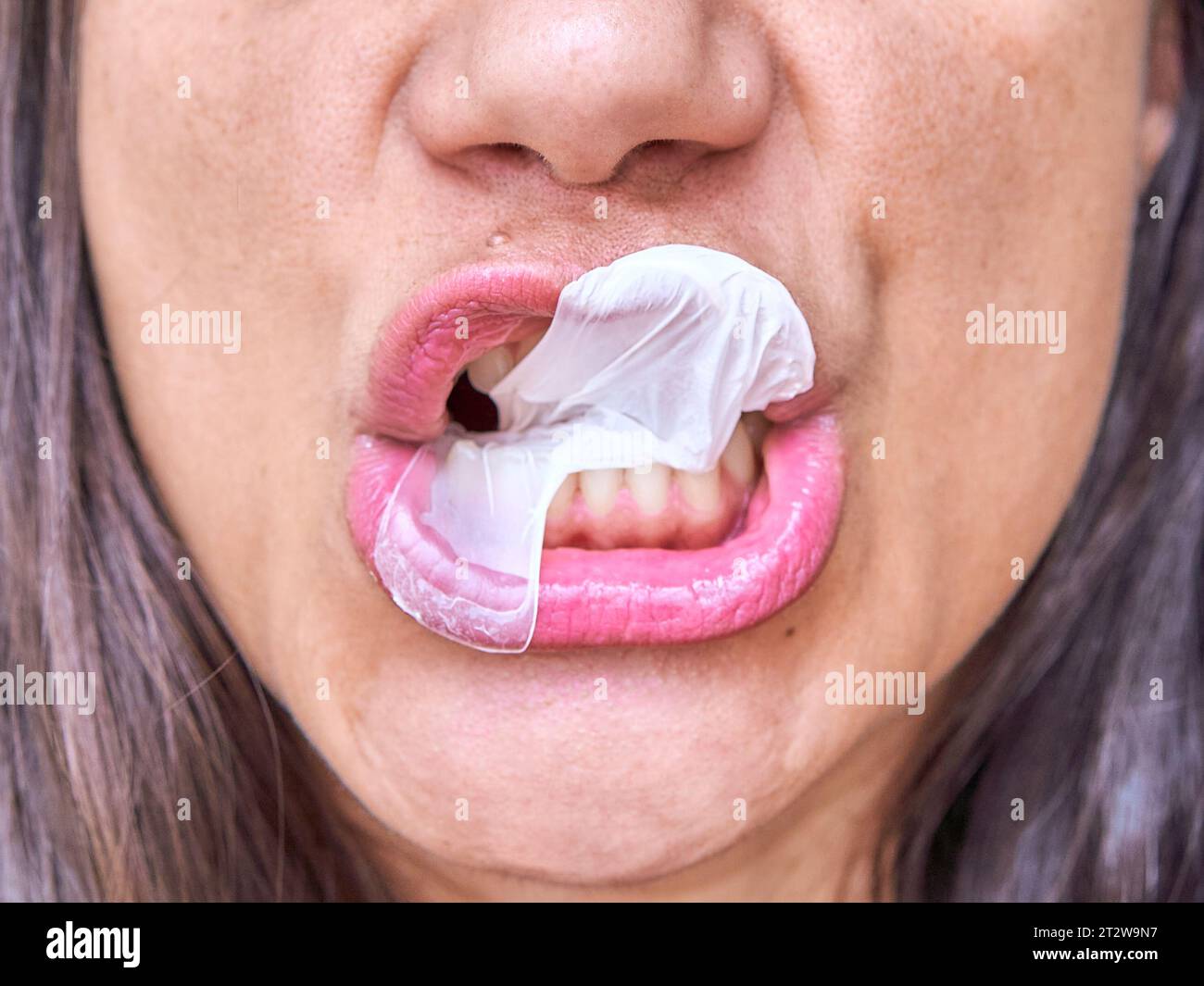 woman mouth showing teeth after a chewing gun balloon explosion Stock Photo