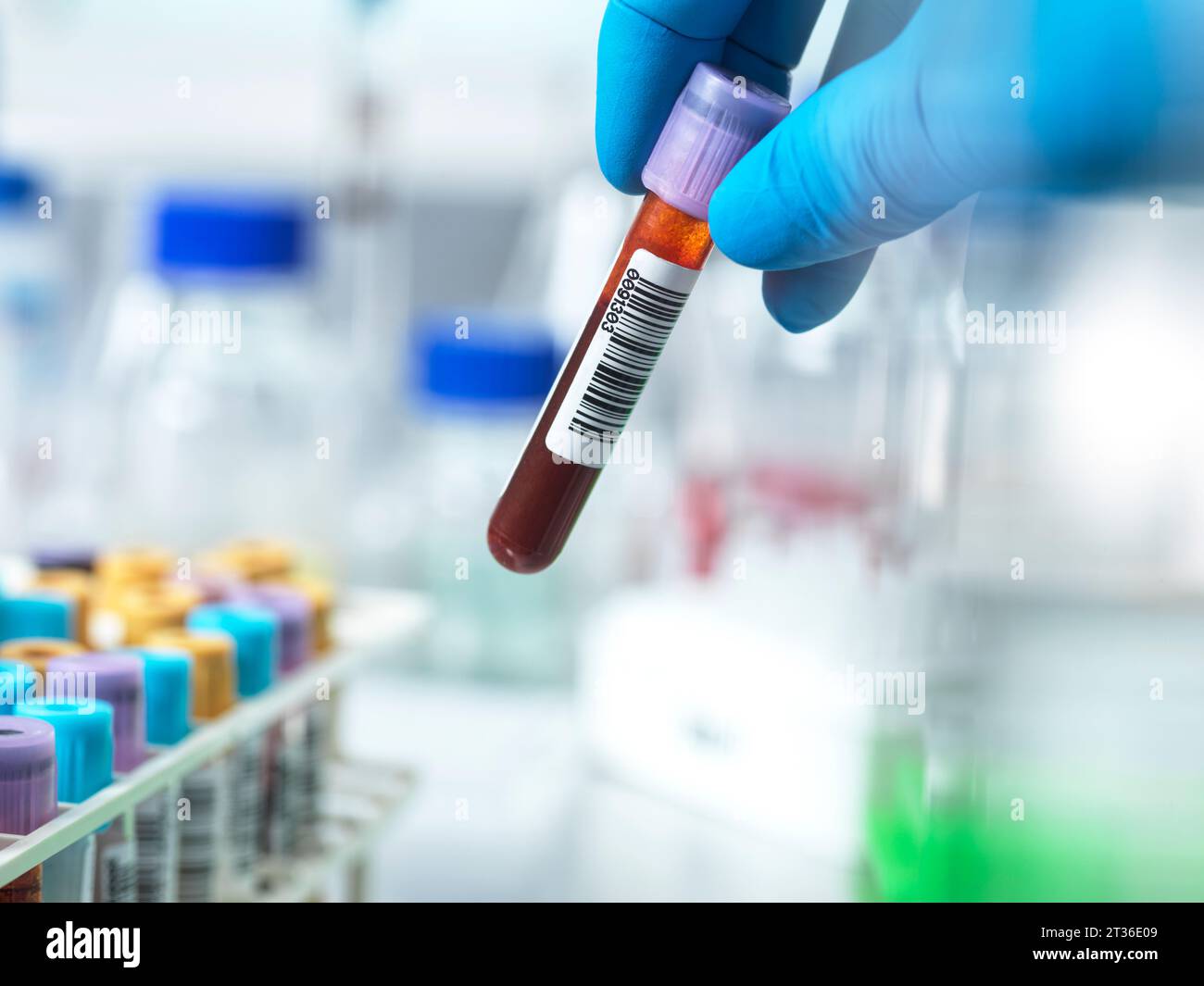 Pathologist holding blood collection tube in laboratory Stock Photo