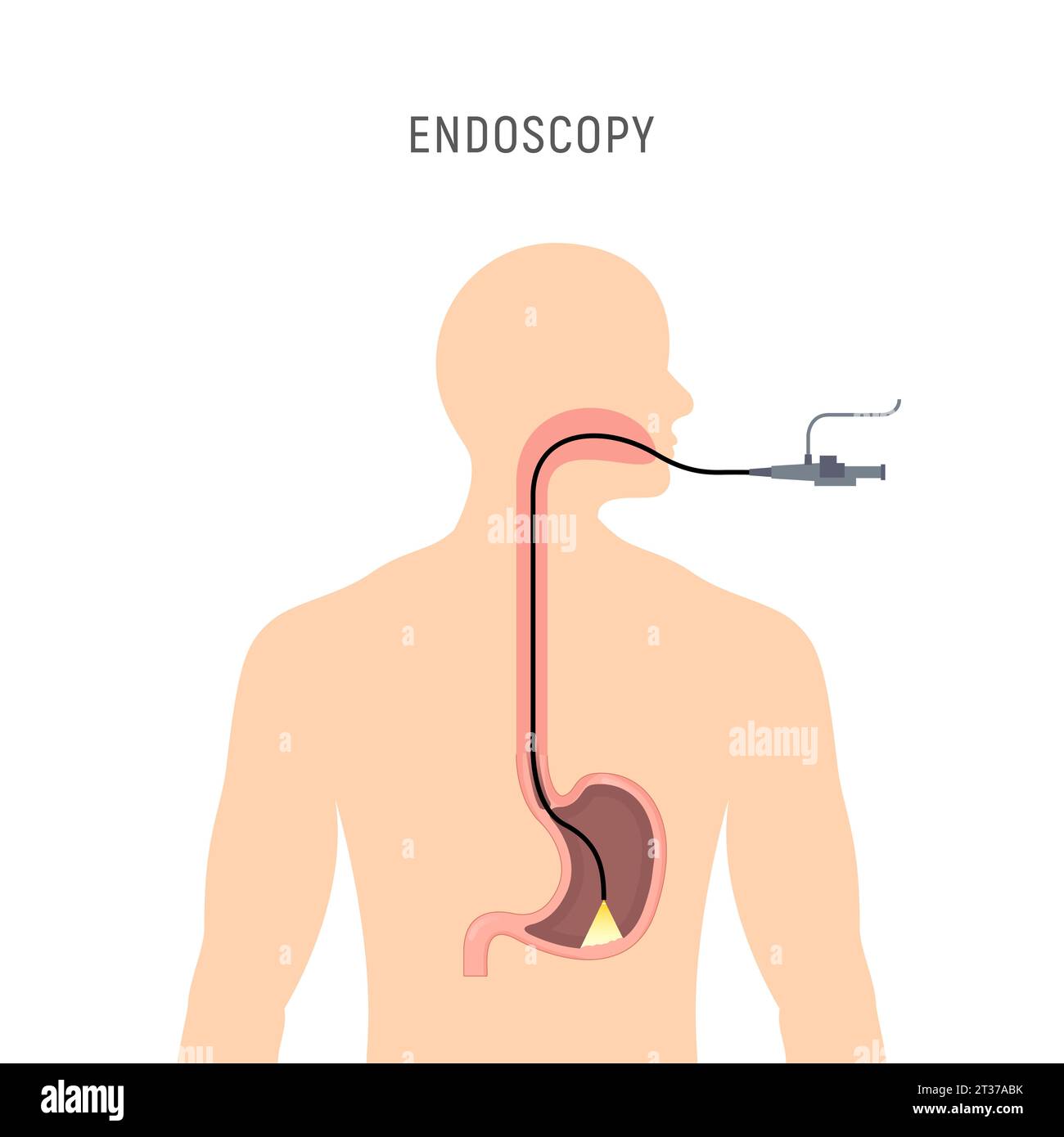 Endoscopy stomach anatomy equipment vector illustration. Esophagus