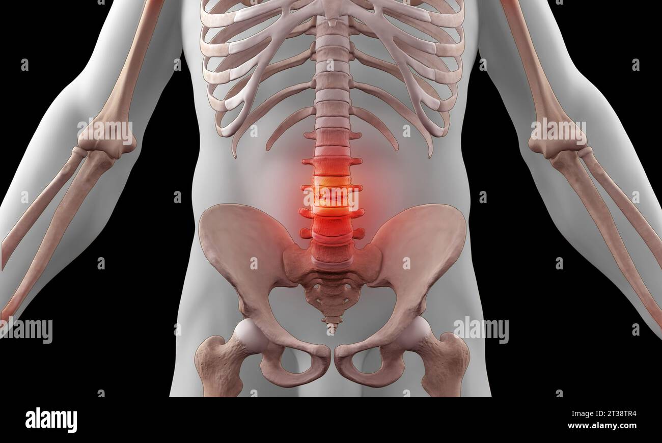 Anatomy of Human Spine. Lower back pain and human backache Stock Photo ...