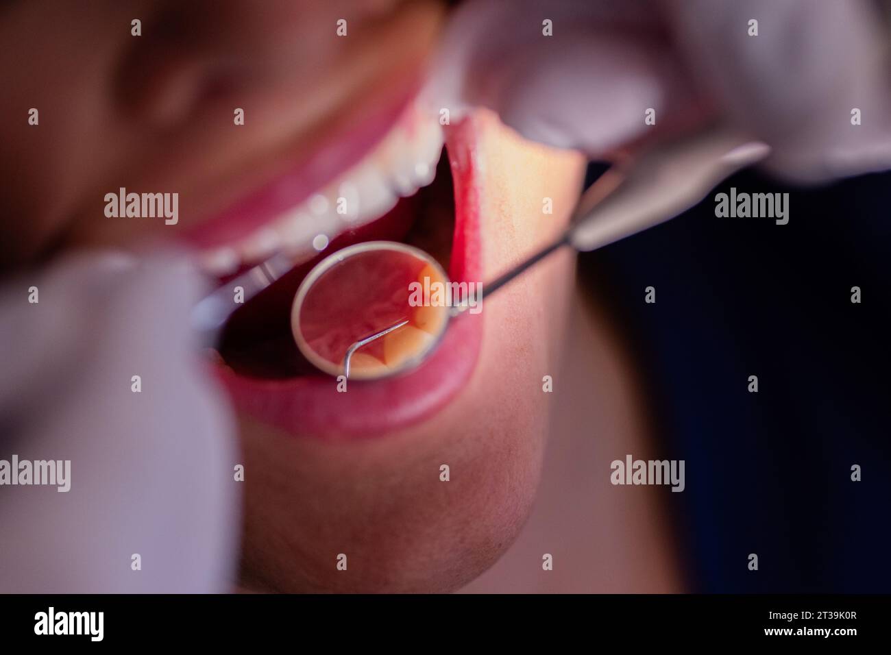 23 October 2023, North RhineWestphalia, Mönchengladbach Dentist Dr. Kranz uses a mirror to