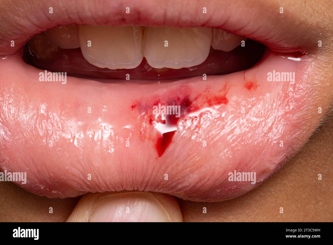 810+ Lábios Vermelhos De Vampiro No Sangue fotos de stock, imagens e fotos  royalty-free - iStock