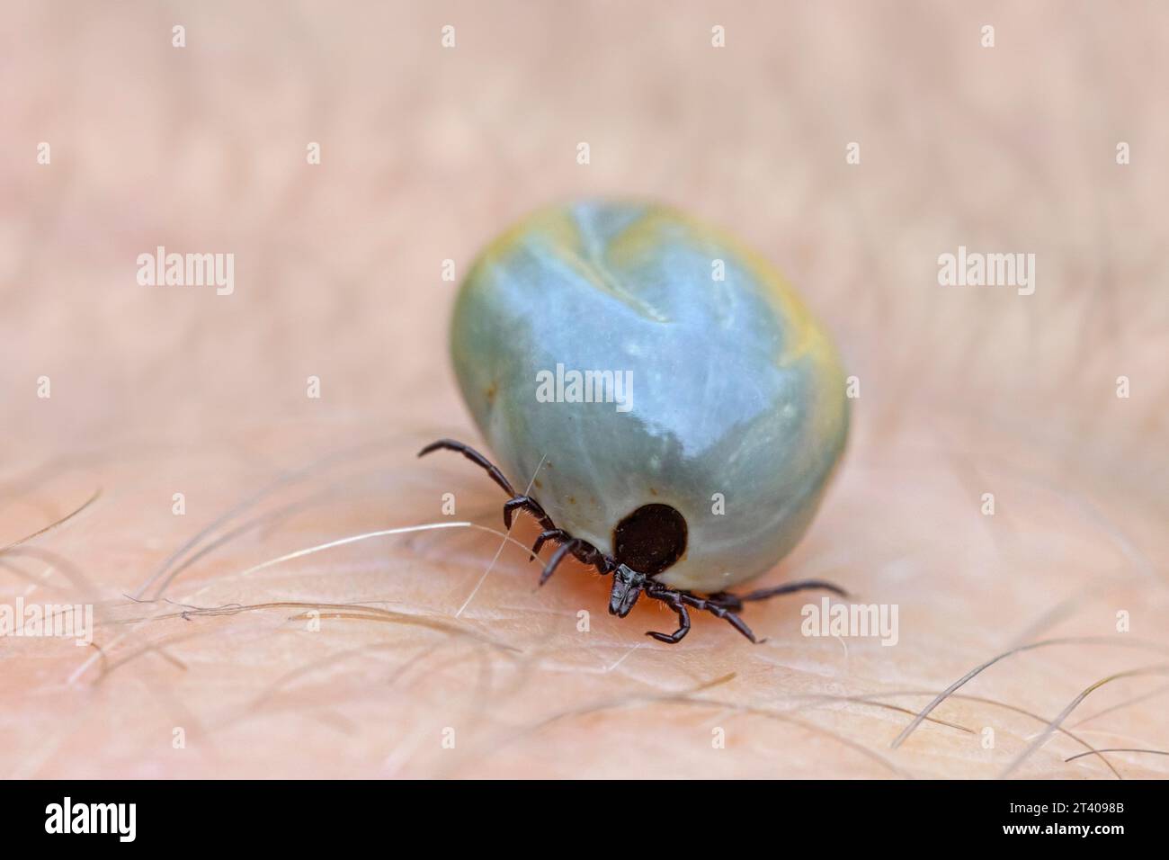 Castor bean tick (Ixodes ricinus) female with blood on human
