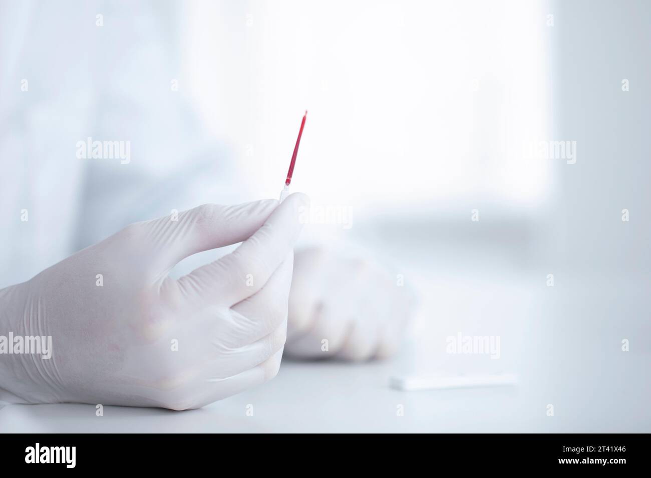 Capillary blood test Stock Photo Alamy