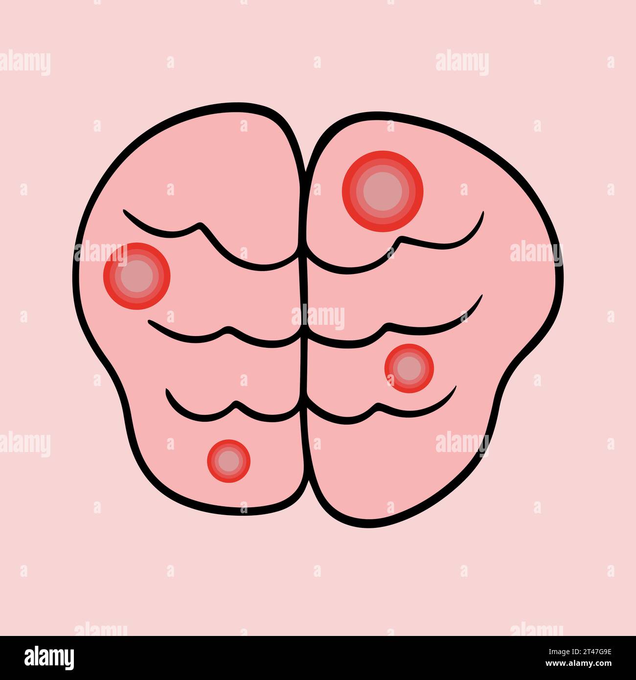 Vector isolated illustration of brain activity. A stroke. Memory problems. Brain storm. Stock Vector