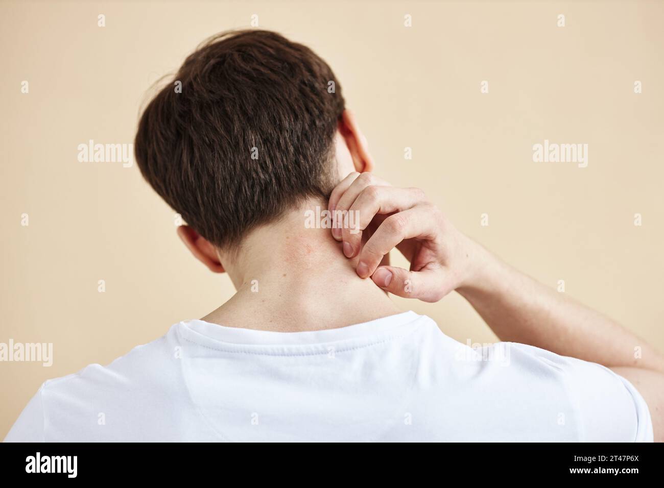 Back view of man scratching neck suffering from rash or skin condition