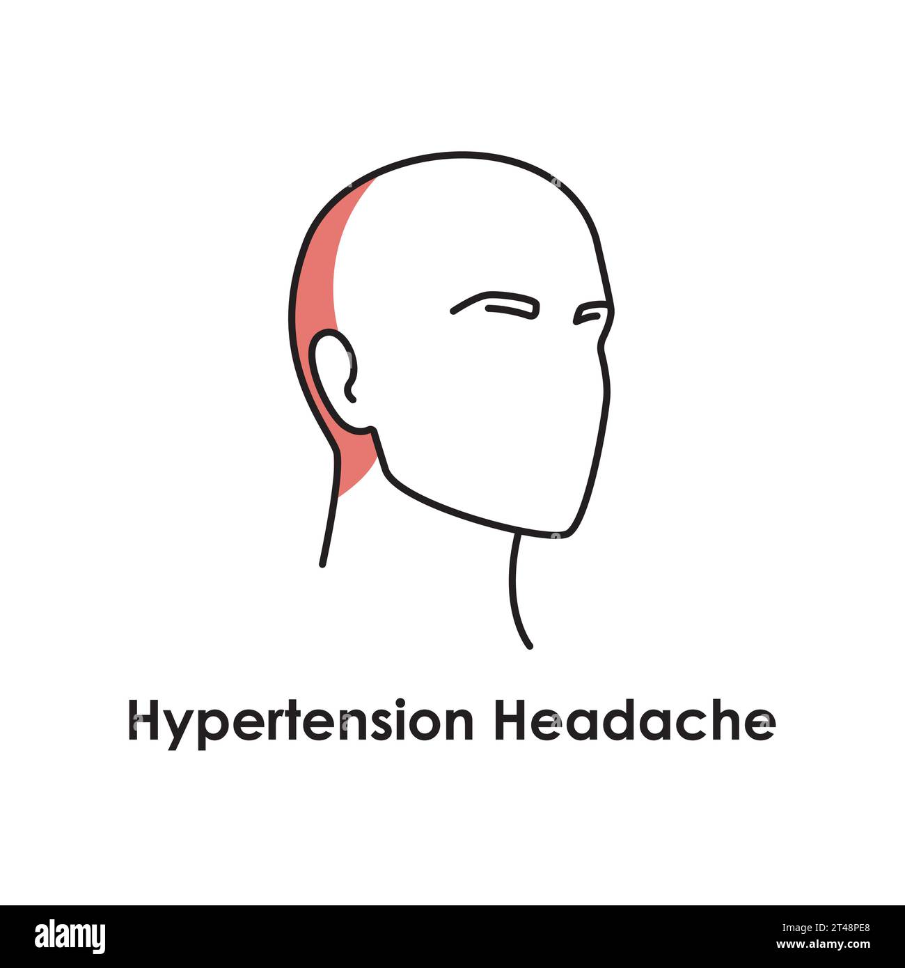 Hypertension Headache color icon. Vector isolated illustration ...