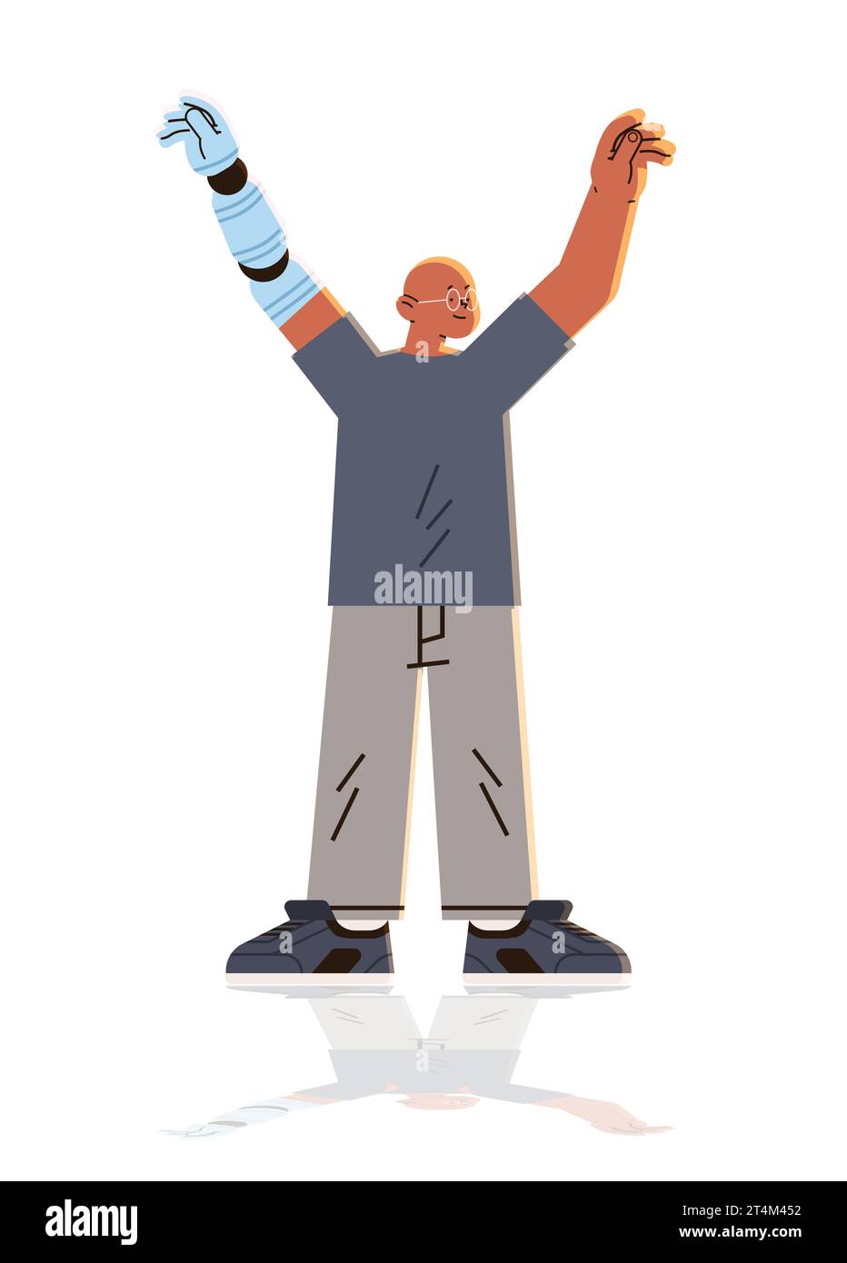 man with replaced robotic arm guy with titanium implant or prosthesis