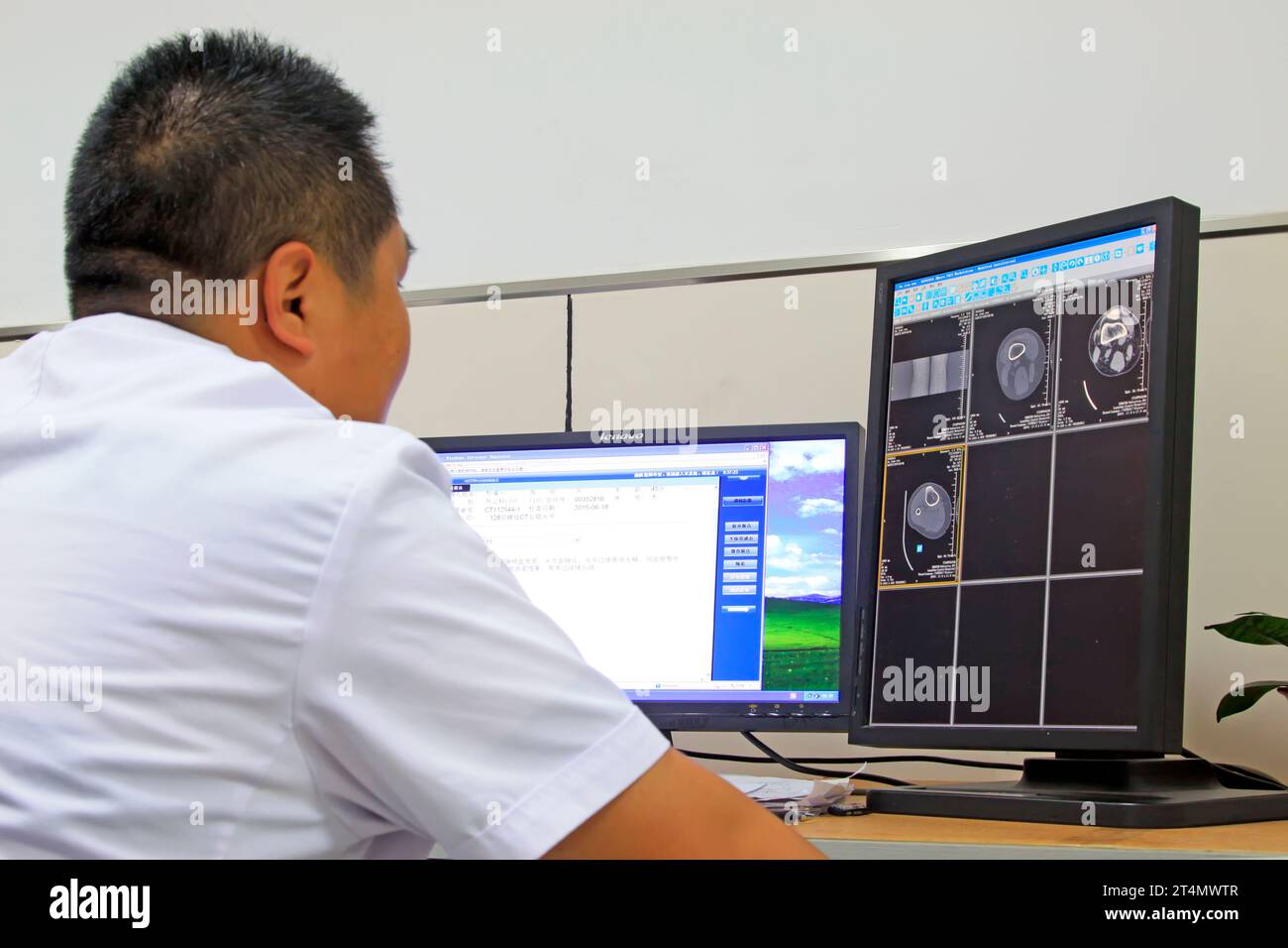 Luannan County - June 18th: a doctor observing CT photos, June 18th, 2015, Luannan County, Hebei Province, China Stock Photo