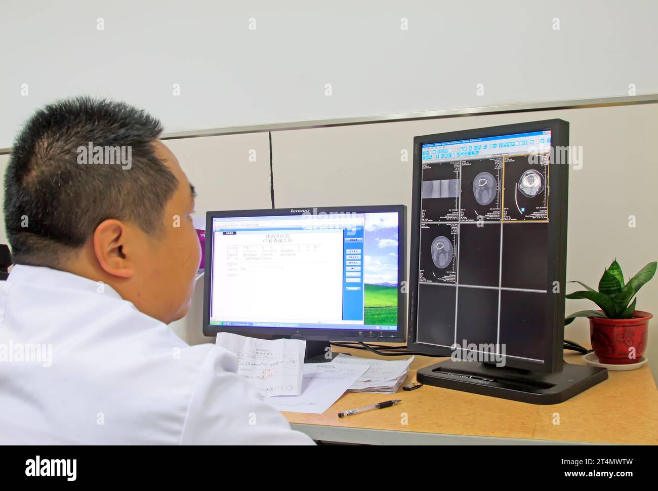 Luannan County - June 18th: a doctor observing CT photos, June 18th, 2015, Luannan County, Hebei Province, China Stock Photo