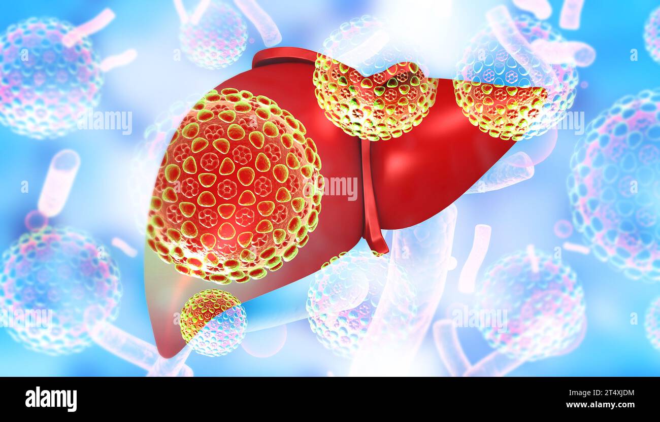 3d illustration of Abstract medical background with Diseased liver Stock Photo