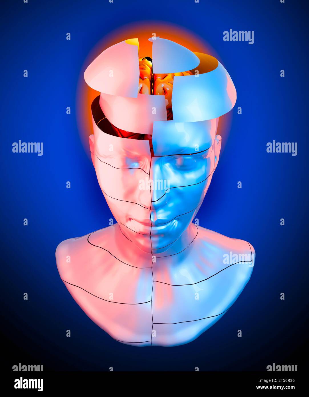 Memory lapses, forgetting things, degenerative disease. Brain problems. Parkinson and alzheimer desease. Mental health. Stroke, synapses and neurons Stock Photo