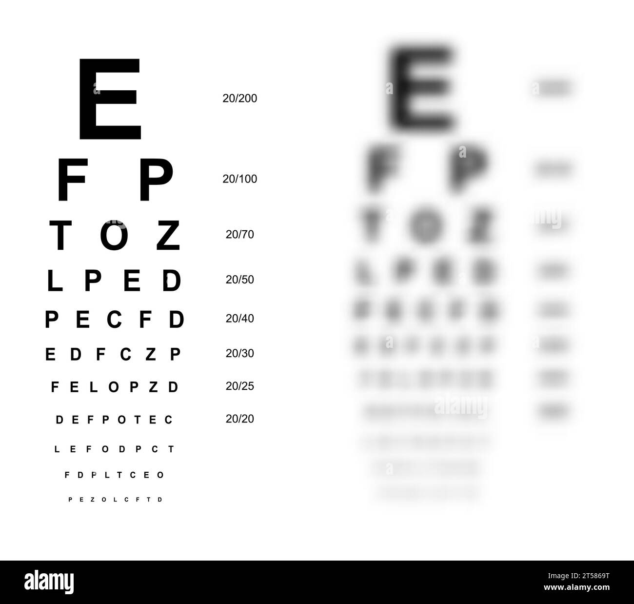 Snellen chart Eye Test medical illustration blurred. line vector sketch style outline isolated on white background. Vision board optometrist ophthalmic test for visual examination Checking optical Stock Vector
