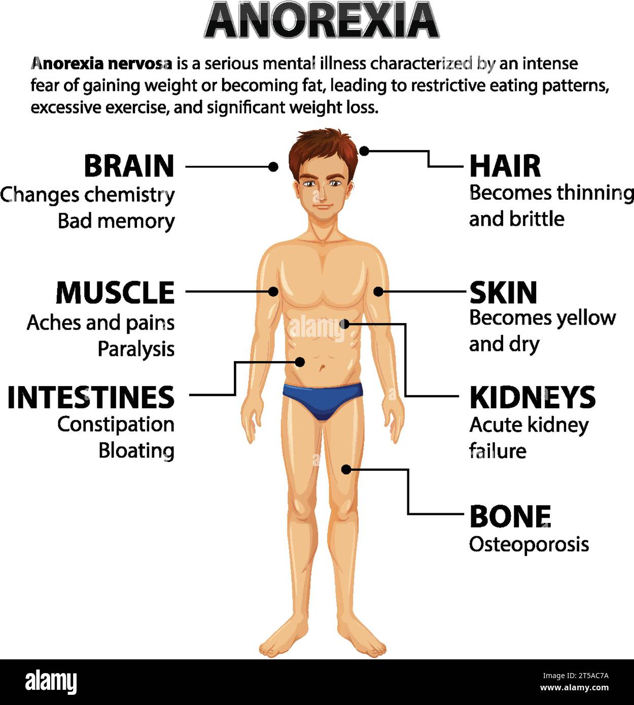 Illustration depicting the impact of Anorexia on various body functions ...