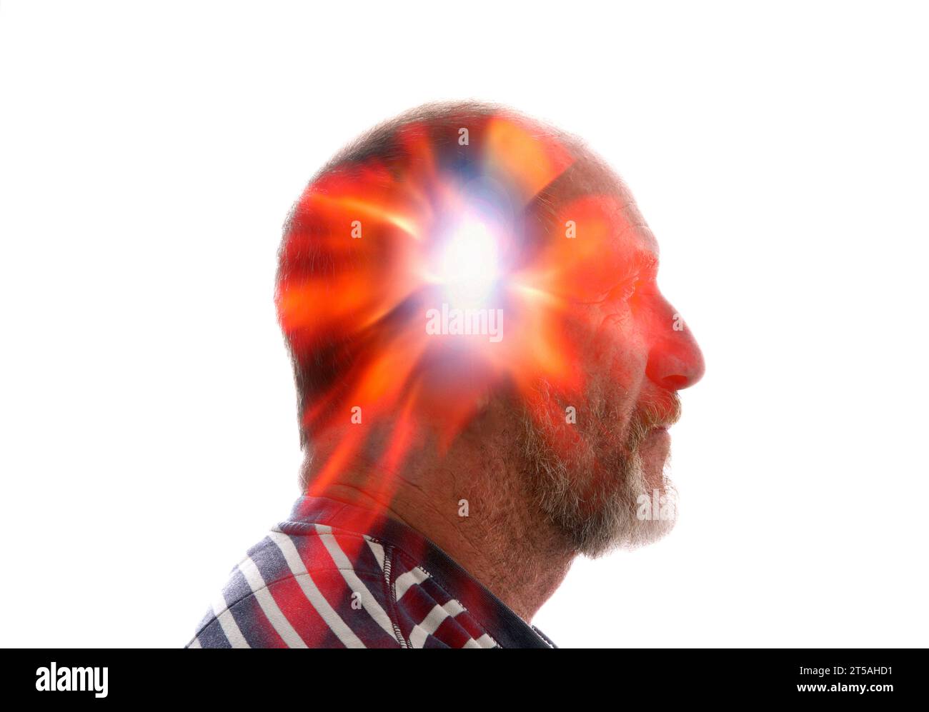 Exploding head syndrome, composite conceptual image. Exploding head