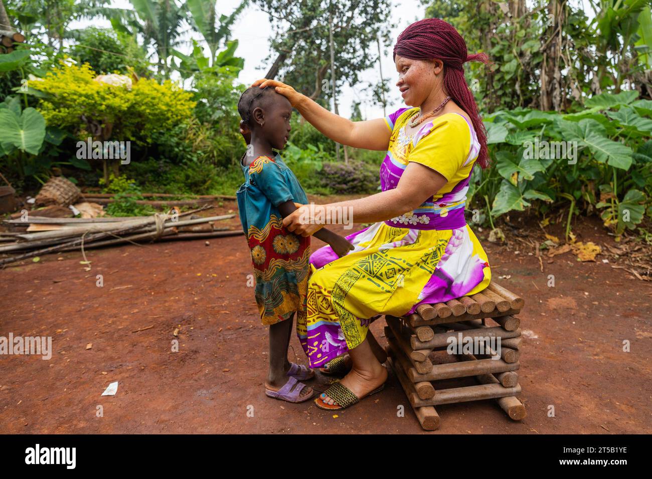Little African girl stands in front of her albino mother who rests her hands on her head. Stock Photo