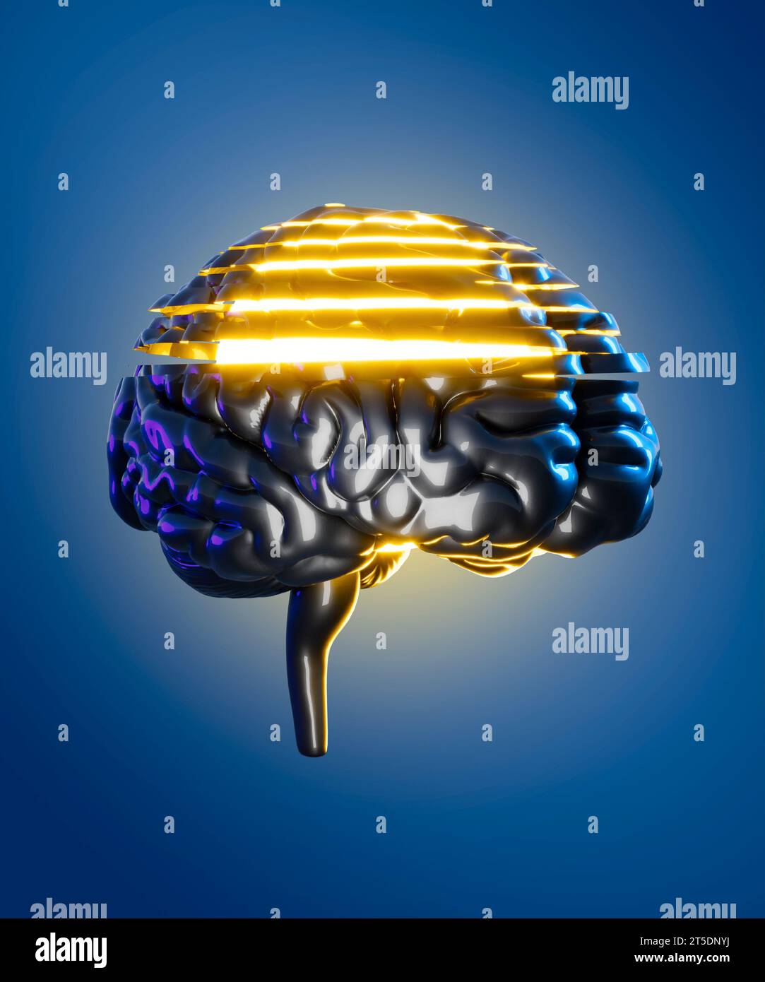 Memory lapses, forgetting things, degenerative disease. Brain problems. Parkinson and alzheimer desease. Mental health. Stroke, synapses and neurons Stock Photo