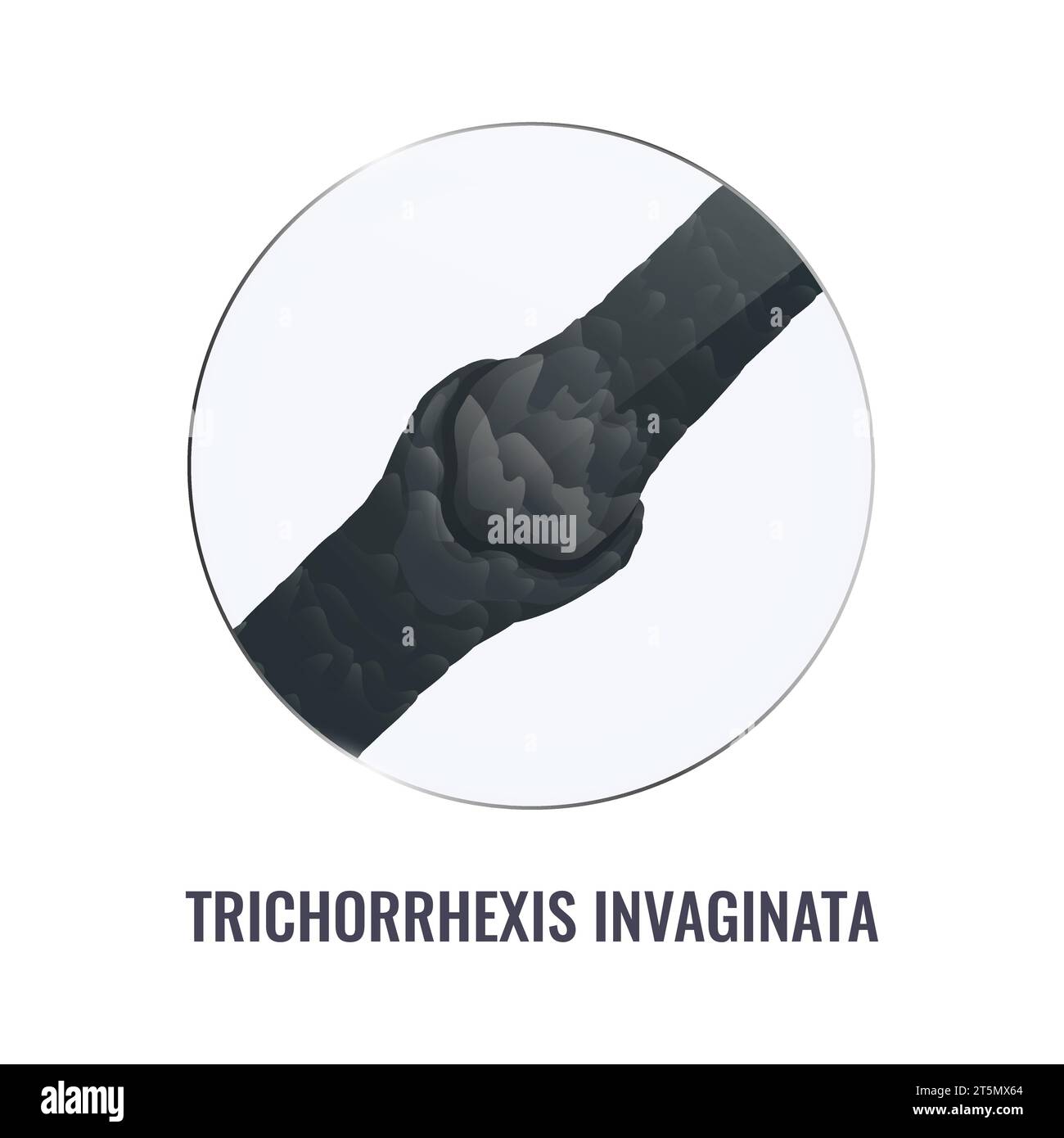 Trichorrhexis invaginata hi-res stock photography and images - Alamy