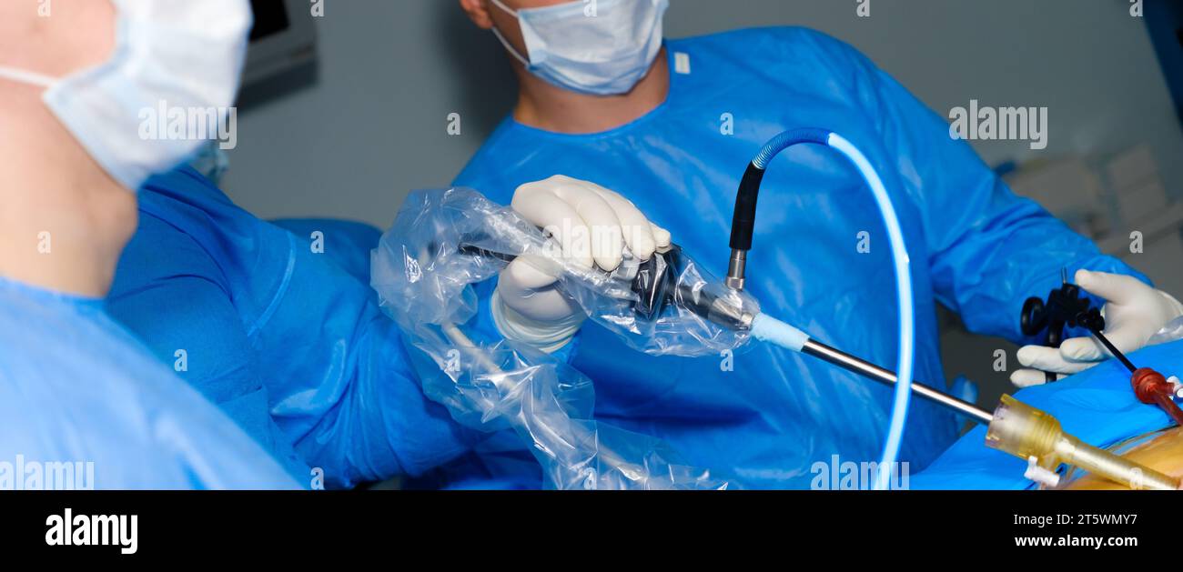 Selective Focus On The Hand Of A Surgeon Operating A Laparoscopic