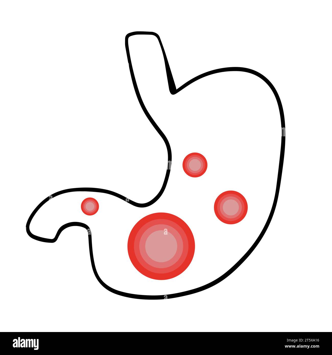 Vector isolated illustration of a stomach with colic. Localization of pain in the stomach. Gas in the stomach. Stock Vector