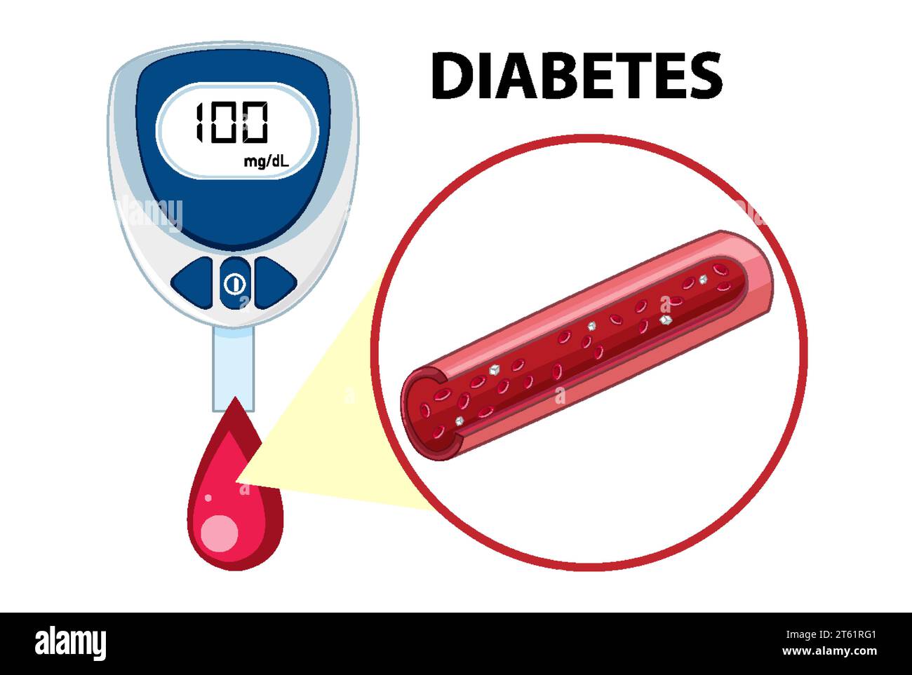 Illustration of a glucose meter device used to check blood sugar levels