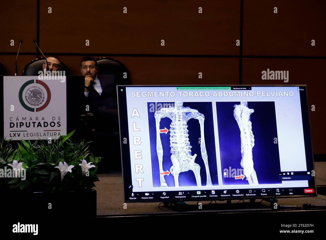 Mexico City, Mexico. 07th Nov, 2023. November 7, 2023, Mexico City, Mexico: Images of non-human bodies investigated by specialists in the UFO phenomenon shown at the Second Mexican Public Hearing on Unidentified Anomalous Phenomena in the Chamber of Deputies in Mexico City. on November 7, 2023 in Mexico City, Mexico (Photo by Luis Barron/Eyepix Group/Sipa USA). Credit: Sipa USA/Alamy Live News Stock Photo