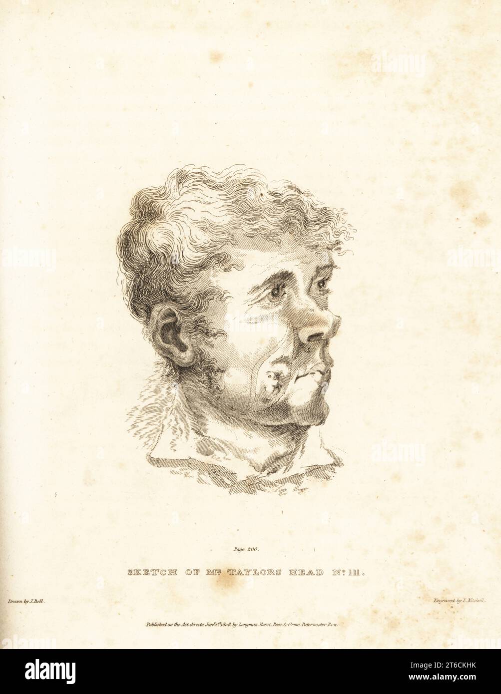 Operation on the tumor in the cheek of Mr Taylor, a 30-year-old Irish man from Cook Town, County Tyrone. The surgeon excised the cancerous growth cutting along the dotted lines, where a is the tuberculous tumor and b the tumor adhering to the gums within the mouth. Sketch of Mr. Taylors No. III. Copperplate engraving by Edward Mitchell after an illustration by John Bell from his own Principles of Surgery, as they Relate to Wounds, Ulcers and Fistulas, Longman, Hurst, Rees, Orme and Brown, London, 1815. Stock Photo