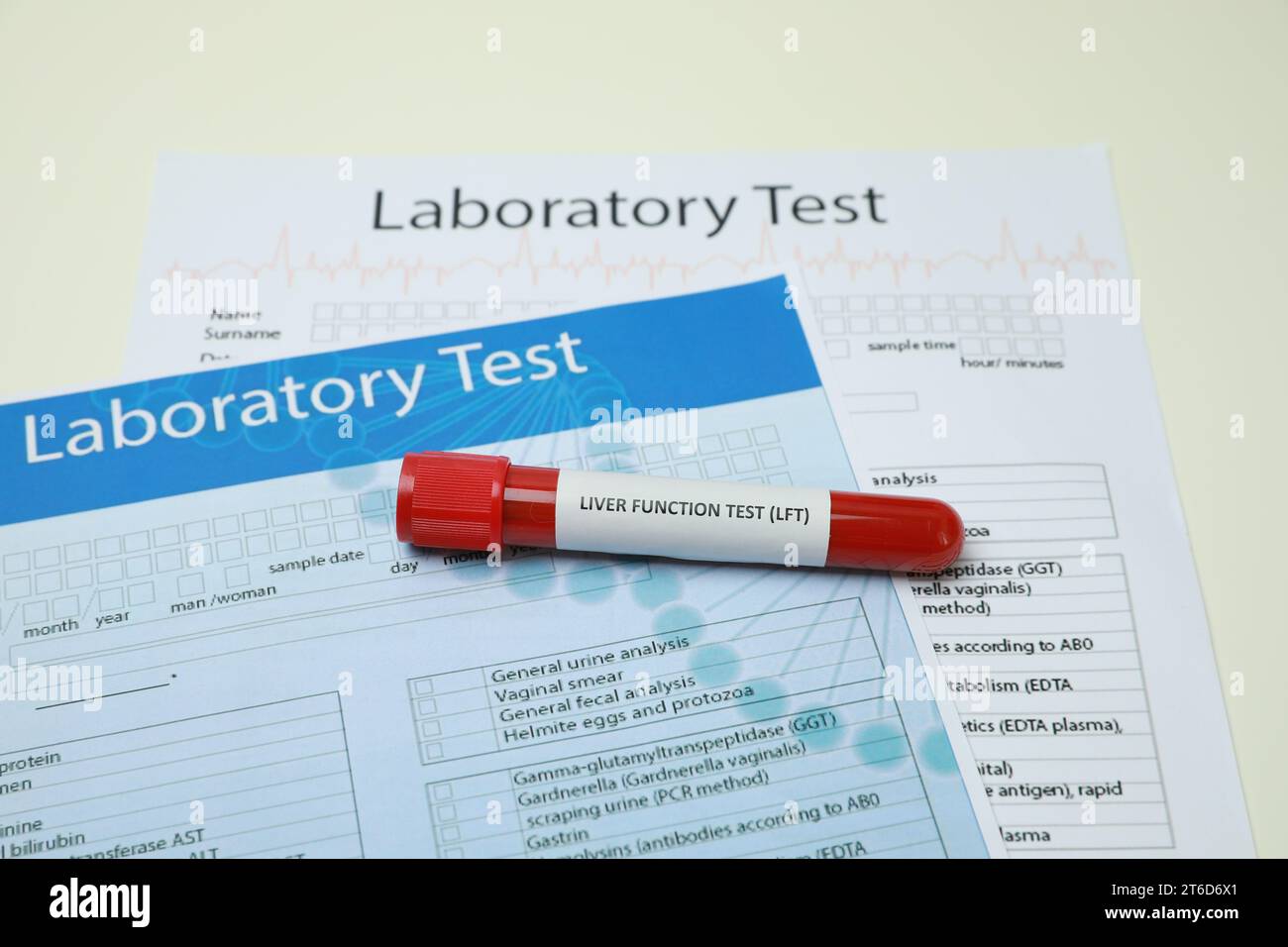 Liver Function Test. Tube with blood sample and forms on white table